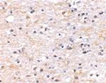 TOCA-1 Antibody in Immunohistochemistry (IHC)