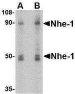 Nhe-1 Antibody in Western Blot (WB)