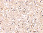 GRIK1 Antibody in Immunohistochemistry (IHC)