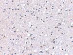 GRIK4 Antibody in Immunohistochemistry (IHC)