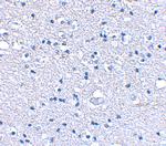 GRIK4 Antibody in Immunohistochemistry (IHC)