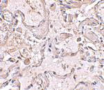 GSTP1 Antibody in Immunohistochemistry (IHC)