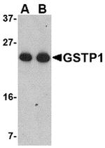 GSTP1 Antibody in Western Blot (WB)