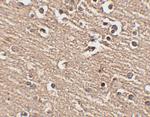 SLITRK1 Antibody in Immunohistochemistry (IHC)