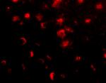 SLITRK1 Antibody in Immunohistochemistry (IHC)