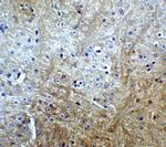 SLITRK1 Antibody in Immunohistochemistry (IHC)