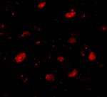 SLITRK5 Antibody in Immunocytochemistry (ICC/IF)