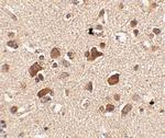 SLITRK6 Antibody in Immunohistochemistry (IHC)