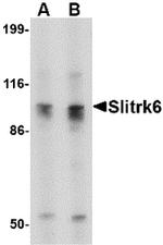 SLITRK6 Antibody in Western Blot (WB)