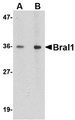 HAPLN2 Antibody in Western Blot (WB)