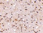 AMBRA1 Antibody in Immunohistochemistry (IHC)