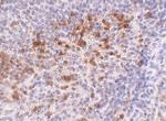 Cathelicidin Antibody in Immunohistochemistry (IHC)