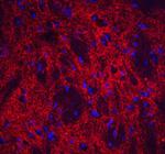 NPTX2 Antibody in Immunohistochemistry (Paraffin) (IHC (P))