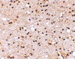 NPTX2 Antibody in Immunohistochemistry (Paraffin) (IHC (P))