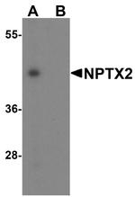 NPTX2 Antibody in Western Blot (WB)