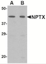 NPTX2 Antibody in Western Blot (WB)