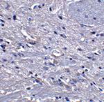 GPAM Antibody in Immunohistochemistry (IHC)