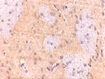 GPAM Antibody in Immunohistochemistry (IHC)