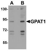 GPAM Antibody in Western Blot (WB)