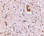 EVER2 Antibody in Immunohistochemistry (IHC)