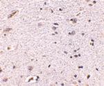 Syntaphilin Antibody in Immunohistochemistry (IHC)