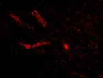 Syntaphilin Antibody in Immunocytochemistry (ICC/IF)