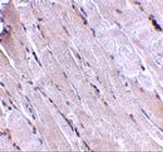 WNT10B Antibody in Immunohistochemistry (IHC)