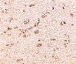 SAPAP1 Antibody in Immunohistochemistry (IHC)