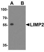 LIMP2 Antibody in Western Blot (WB)