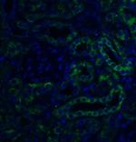 SLC22A17 Antibody in Immunohistochemistry (IHC)