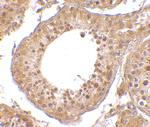 RGPD5 Antibody in Immunohistochemistry (IHC)