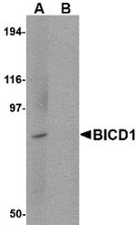 BICD1 Antibody in Western Blot (WB)