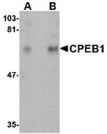 CPEB1 Antibody in Western Blot (WB)