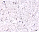 Lass5 Antibody in Immunohistochemistry (IHC)