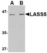 Lass5 Antibody in Western Blot (WB)