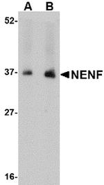 NENF Antibody in Western Blot (WB)