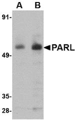 PARL Antibody in Western Blot (WB)