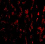 GP6 Antibody in Immunohistochemistry (IHC)