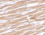 GP6 Antibody in Immunohistochemistry (IHC)