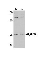 GP6 Antibody in Western Blot (WB)