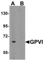 GP6 Antibody in Western Blot (WB)