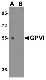 GP6 Antibody in Western Blot (WB)