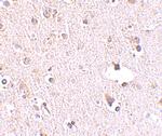 POLR3F Antibody in Immunohistochemistry (IHC)