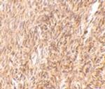 TRIM30 Antibody in Immunohistochemistry (IHC)