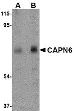 Calpain 6 Antibody in Western Blot (WB)