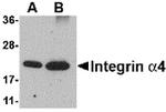 ITGA4 Antibody in Western Blot (WB)