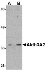 ALDH3A2 Antibody in Western Blot (WB)