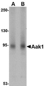 AAK1 Antibody in Western Blot (WB)