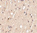 SPRED1 Antibody in Immunohistochemistry (IHC)