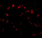 SPRED1 Antibody in Immunohistochemistry (IHC)